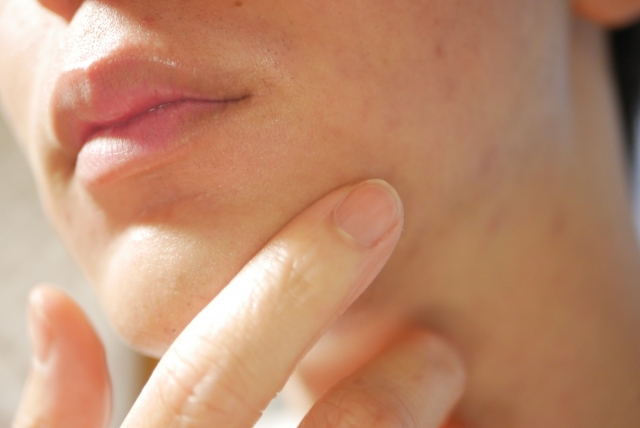 男性 スキンケア